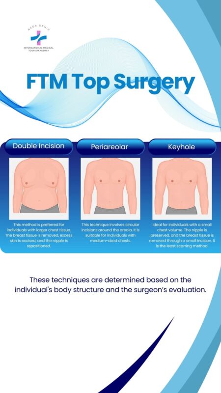 Top Surgery