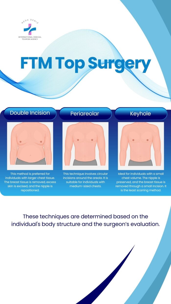 What Is Top Surgery? Types, Results & Recovery