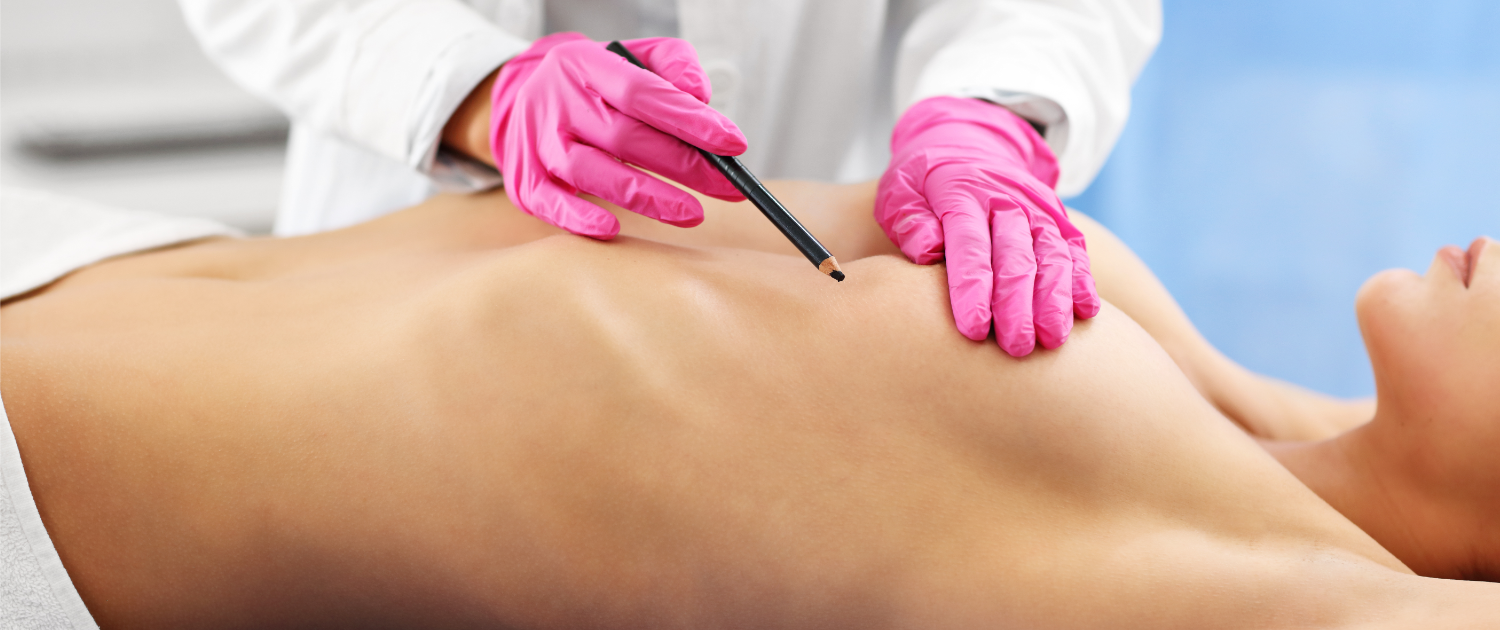 Best Top Surgery Surgeons