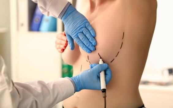 Breast Removal Surgery